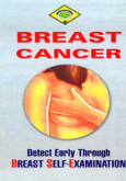 Breast Cancer